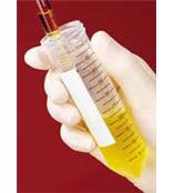 05-539-7塑料离心管