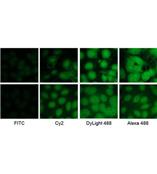 Jackson公司优质二抗