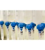 StarLine免疫亲和柱