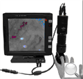微循环观察仪|血液循环观察仪，相位观察仪，显像仪，LED显微镜