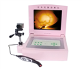 便携红外线乳房诊断仪,便携红外线乳腺扫描仪价格