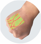 静脉显像仪厂家价格